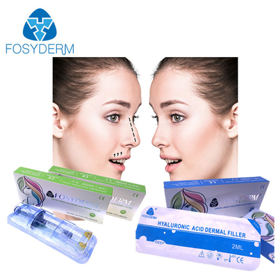 Fosyderm 2 ml Υαλουρονικό οξύ Δερμικό γεμιστήρα για ρυτίδες στο πρόσωπο χείλη πηγούνι μάγουλα