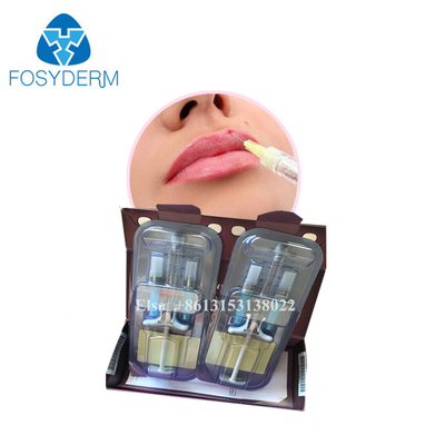 Juvederm Ενέσεις δερματικής γέμισσης για τις ρυτίδες, Υαλουρονικό οξύ για τα χείλη