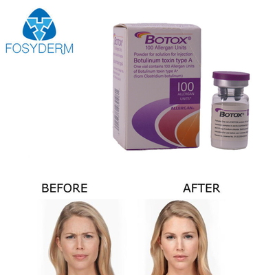 Ένεση Botox Allergan 100 Μονάδων για Εξάλειψη Ρυτίδων