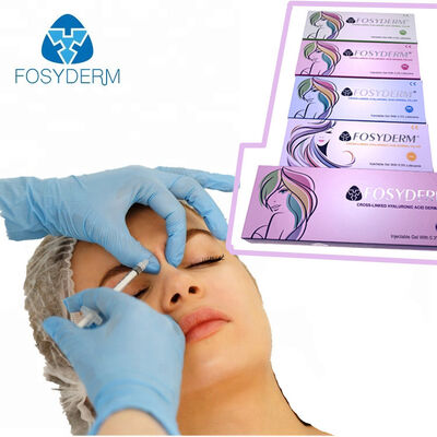 Fosyderm Hyaluronic Acid Facial Filler Ενέσιμη δερματική συσκευή πλήρωσης