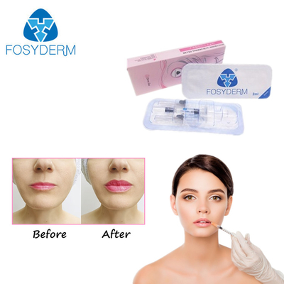 Συνδεμένο σταυρός εγχύσεων πηκτωμάτων Hyaluronic όξινο δερμικό CE ISO γήρανσης υλικών πληρώσεως αντι