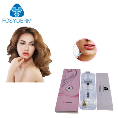 Διασυνδεμένο Hyaluronic όξινο δερμικό υλικό πληρώσεως εκταρίου με την προ γεμισμένη σύριγγα