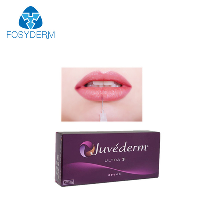 Hyaluronic όξινο δερμικό υλικό πληρώσεως εξαιρετικά 3 2*1ml χειλικού Juvederm