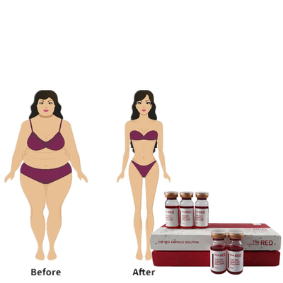 Μέση κόκκινη Lipo αμελής Lipolytic Mesotherapy έγχυση Lipo