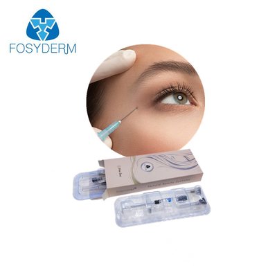 Hyaluronic όξινο χειλικό 1ml εκχύσιμο εκτάριο δερμικό υλικό πληρώσεως