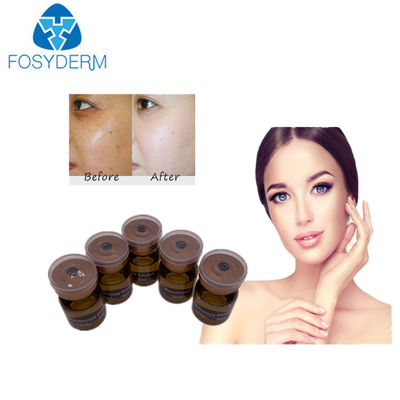 ορός 20mg/ml 5ml Mesotherapy που λευκαίνει τη μέση λύση