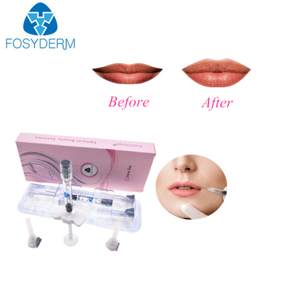2ml δερμικά διαγώνια συνδεμένα Hyaluronic υλικά πληρώσεως μανδρών