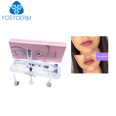 Hyaluronic όξινη 1ml 0.28mm εκτάριο δερμική χειλική έγχυση υλικών πληρώσεως