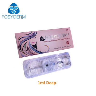 Εγχύσεις 24mg/Ml υλικών πληρώσεως Fosyderm βαθιά δερμικές Hyaluronic όξινες για το πηγούνι Augement
