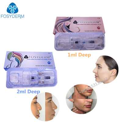 Ο σταυρός σύνδεσε το εκχύσιμο Hyaluronic όξινο δερμικό υλικό πληρώσεως 1ml 2ml πηκτωμάτων για το χειλικό του προσώπου δέρμα