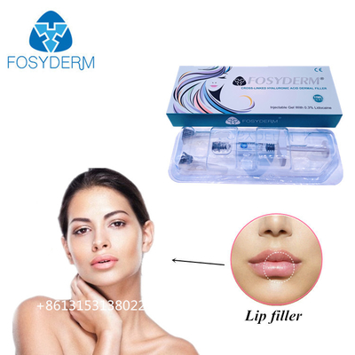 Fosyderm 1 ml Υαλουρονικό οξύ Ενέσεις δερματικού γεμιστήρα για την αύξηση του μεγέθους των χειλιών