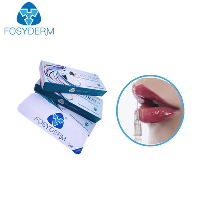 Αύξηση 1,1 Hyaluronic όξινη χειλιών υλικών πληρώσεως μιλ. Derm 24 MG με τη λιδοκαΐνη