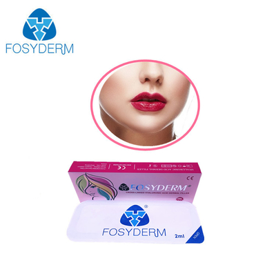 2 χειλική αύξηση μανδρών Hyaluron γραμμών μιλ. Derm με τη λιδοκαΐνη