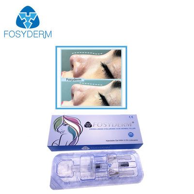 2 μιλ. βαθιά μύτη υλικών πληρώσεως γραμμών Hyaluronic όξινη δερμική επάνω με τη λιδοκαΐνη