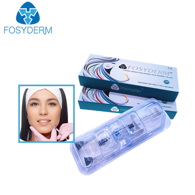 1.1ml Derm δερμικό υλικό πληρώσεως προσώπου χειλικών υλικών πληρώσεως Hyaluronic όξινο εκχύσιμο