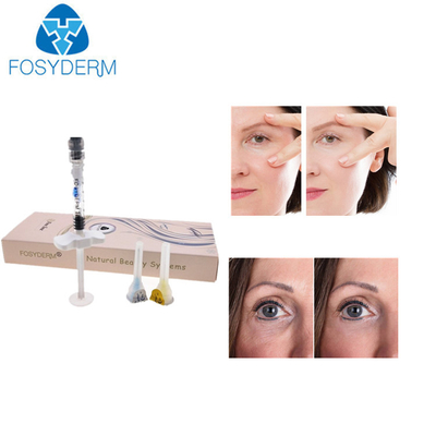 Ματιών ρυτίδων Hyaluronic όξινο δερμικό υλικό πληρώσεως εγχύσεων ρυτίδων υλικών πληρώσεως του προσώπου