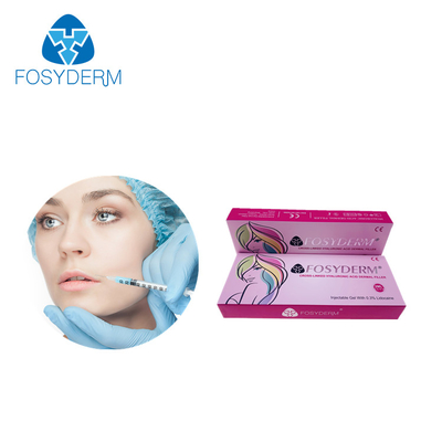 Fosyderm 2ml δερμικό δερμικό υλικό πληρώσεως εγχύσεων χειλικών υλικών πληρώσεως Hyaluronic όξινο