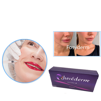Juvederm εξαιρετικά 3 εξαιρετικά 4 δερμική έγχυση πηκτωμάτων υλικών πληρώσεως Voluma εκτάρια