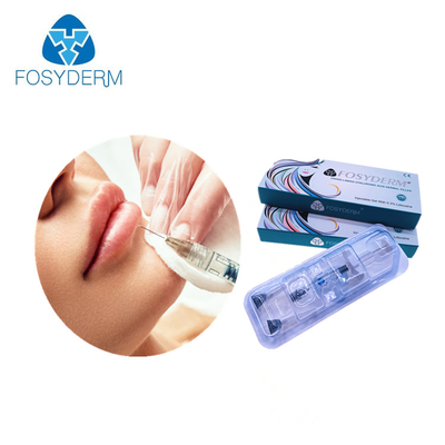 Hyaluronic όξινο υλικό πληρώσεως νατρίου πηκτωμάτων για το χείλι εκχύσιμο 1.1ml