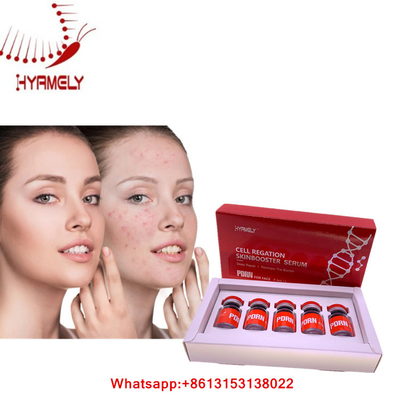 Ορός PDRN για την του προσώπου έγχυση Mesotherapy Hyamely αναγέννησης δερμάτων