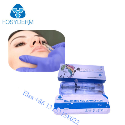 Όξινο δερμικό υλικό πληρώσεως Hyaluornic Fosyderm εκχύσιμο με τα υλικά πληρώσεως προσώπου χειλικής μύτης lidociane 2ml