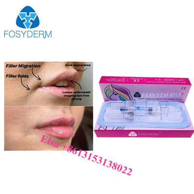Υαλουρονικό οξύ Ha Ενέσεις 1 ml 2 ml 5 ml