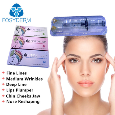 πηγούνι χειλικής μύτης 2ml Fosyderm που γεμίζει το υλικό πληρώσεως εκταρίου που μειώνει τις ρυτίδες