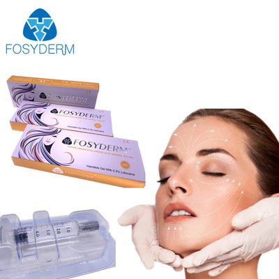 του προσώπου έγχυση υλικών πληρώσεως 5ml Fosyderm για την αύξηση πεών άκρης στηθών