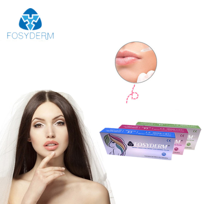 Hyaluronic όξινη έγχυση νατρίου υλικών πληρώσεως προσώπου 1ml διαγώνια συνδεμένη δερμική
